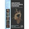 Aneurysms-Osteoarthritis Syndrome by Denise Van der Linde Paperback Book